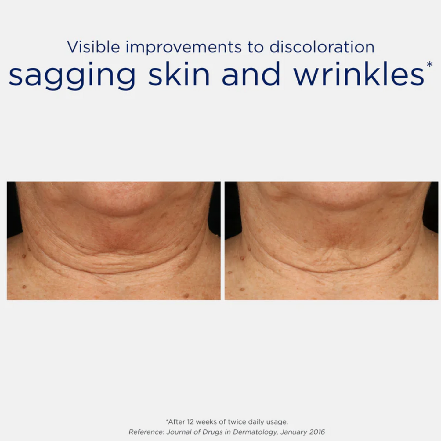 Triple Tightening Neck Cream with MicroDiPeptide229®